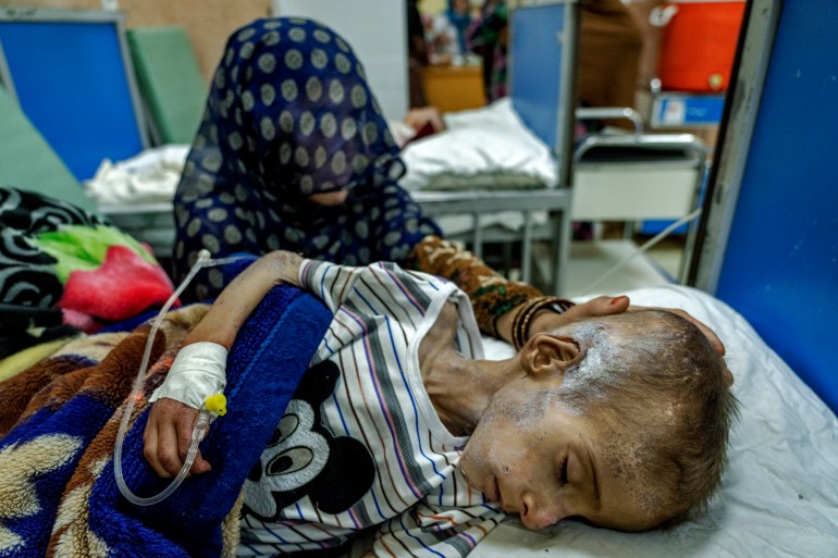 FILE - A mother holds her malnourished boy at the Indira Gandhi hospital in Kabul, Afghanistan, Sunday, May 22, 2022. U.N. humanitarian chief Martin Griffiths told the U.N. Security Council on Monday, Aug. 30, 2022, that Afghanistan faces deepening poverty with 6 million people at risk of famine as he urged donors to immediately provide $770 million to help Afghans get through the winter. (AP Photo/Ebrahim Noroozi, File)