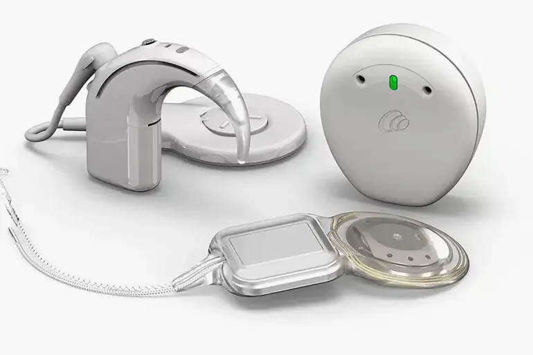 Cochlear Launches World’s First and Only Smart Cochlear Implant System credit : cochlear